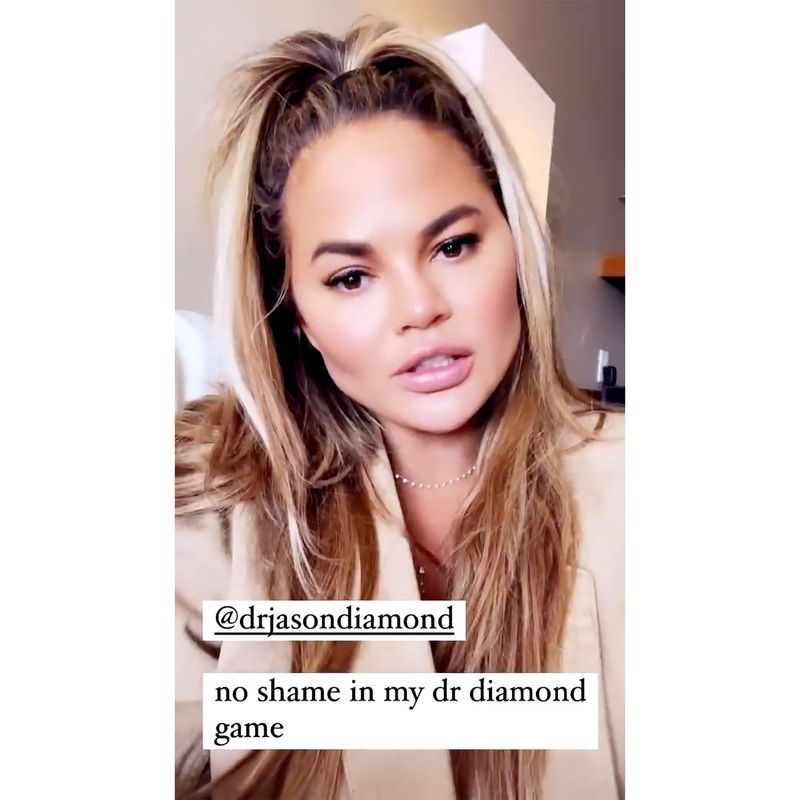 Chrissy Teigen afslører resultaterne af