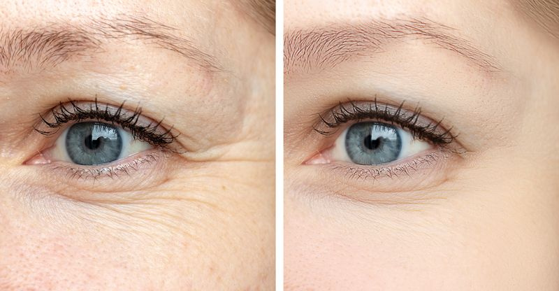 Vorher-Nachher-Augenfalten-Serum-Creme
