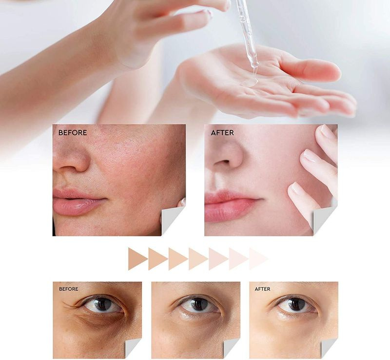Evagloss Dark Spot Corrector Serum med Kojic Acid