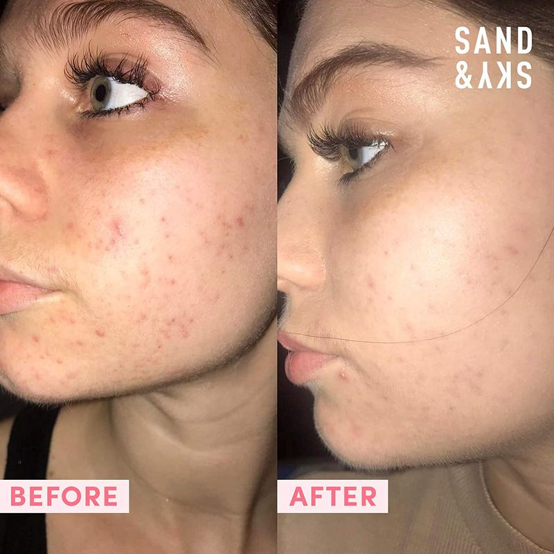 Sand & Sky Australian Pink Clay Porenbildende Gesichtsmaske