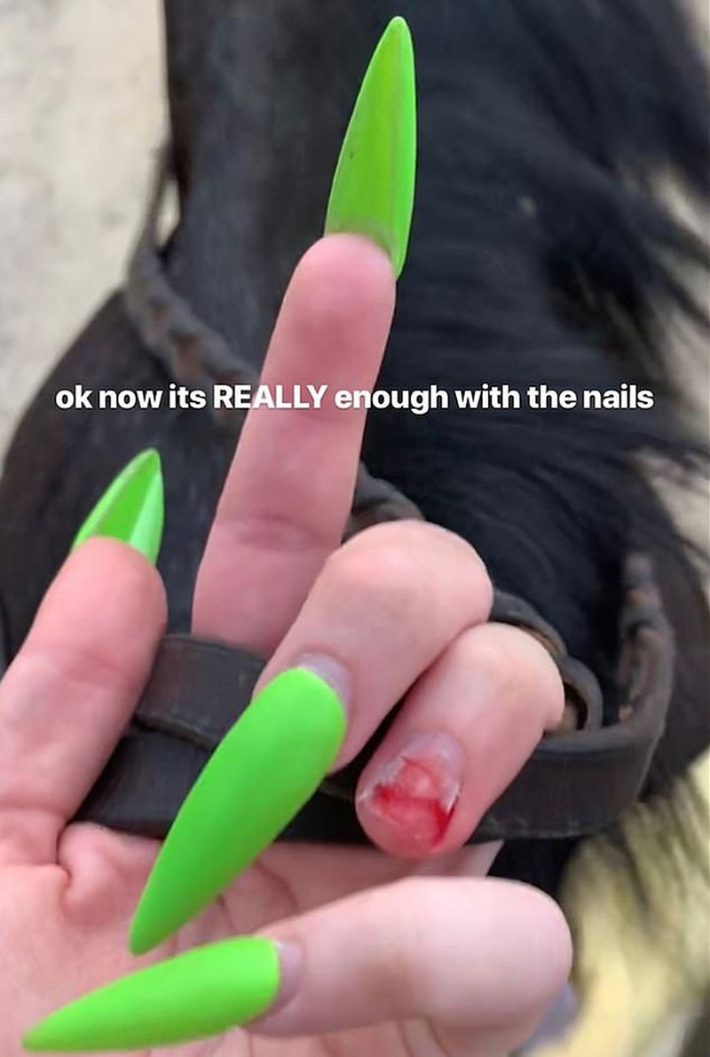 Príbeh Billie Eilish o nehode nechtov na Instagrame